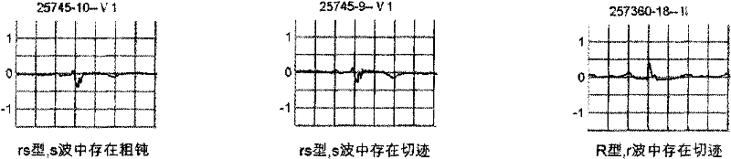 Electrocardiographic data sampling method and device