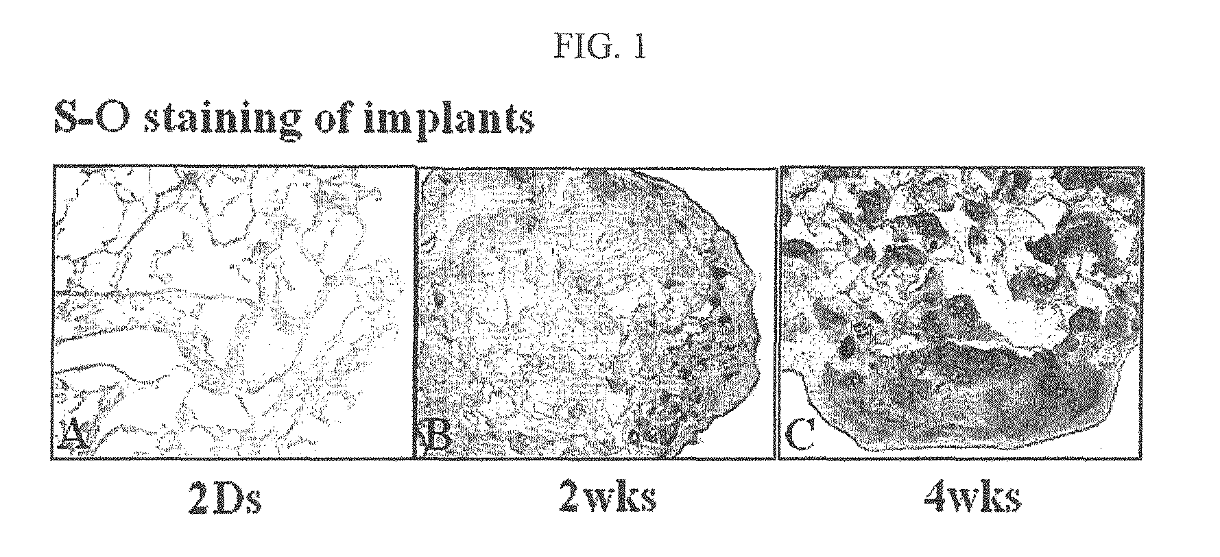 Therapeutic composite for cartilage disorder using extracellular matrix (ECM) scaffold