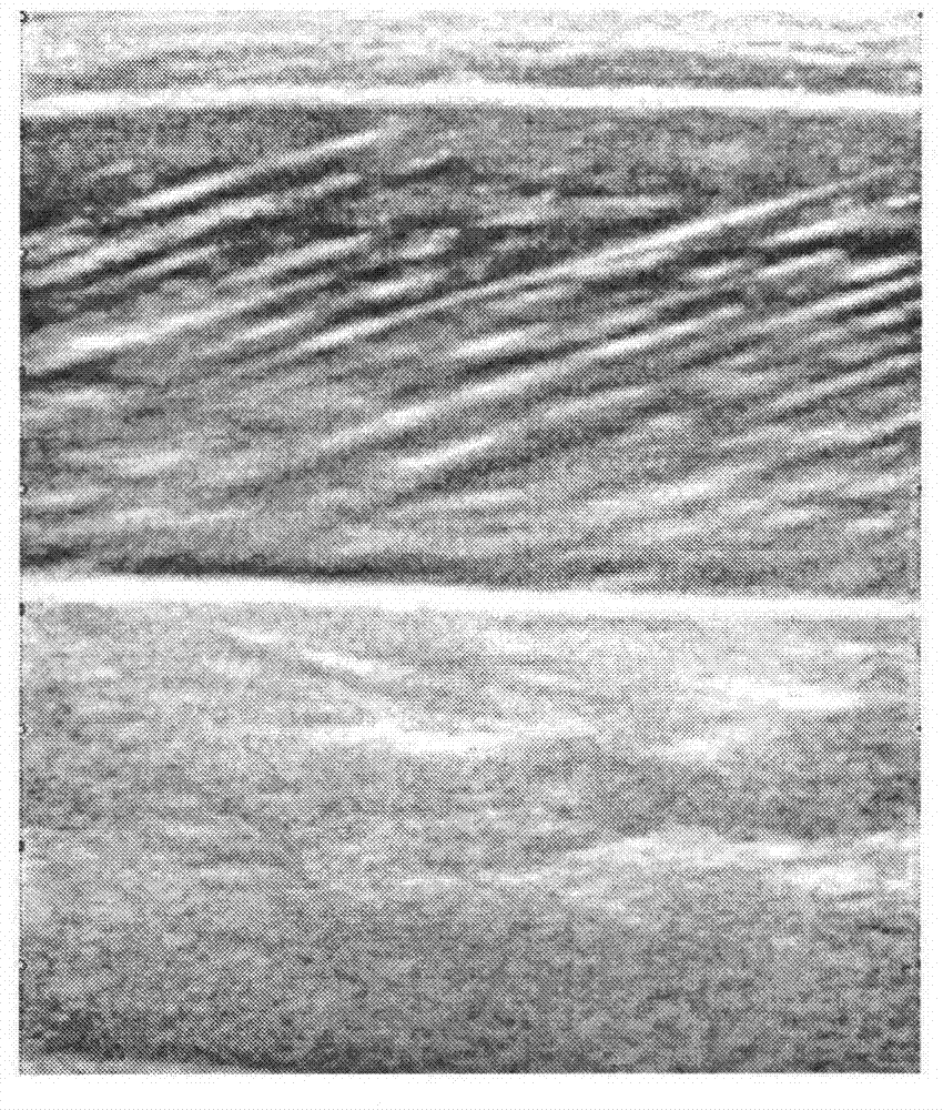 Processing method of muscle image by utilizing Hough transform