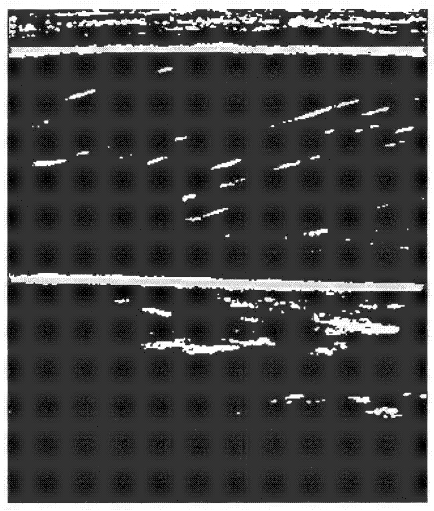 Processing method of muscle image by utilizing Hough transform