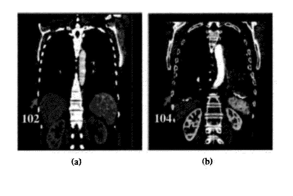 Method and System for Automatic Rib Centerline Extraction Using Learning Base Deformable Template Matching