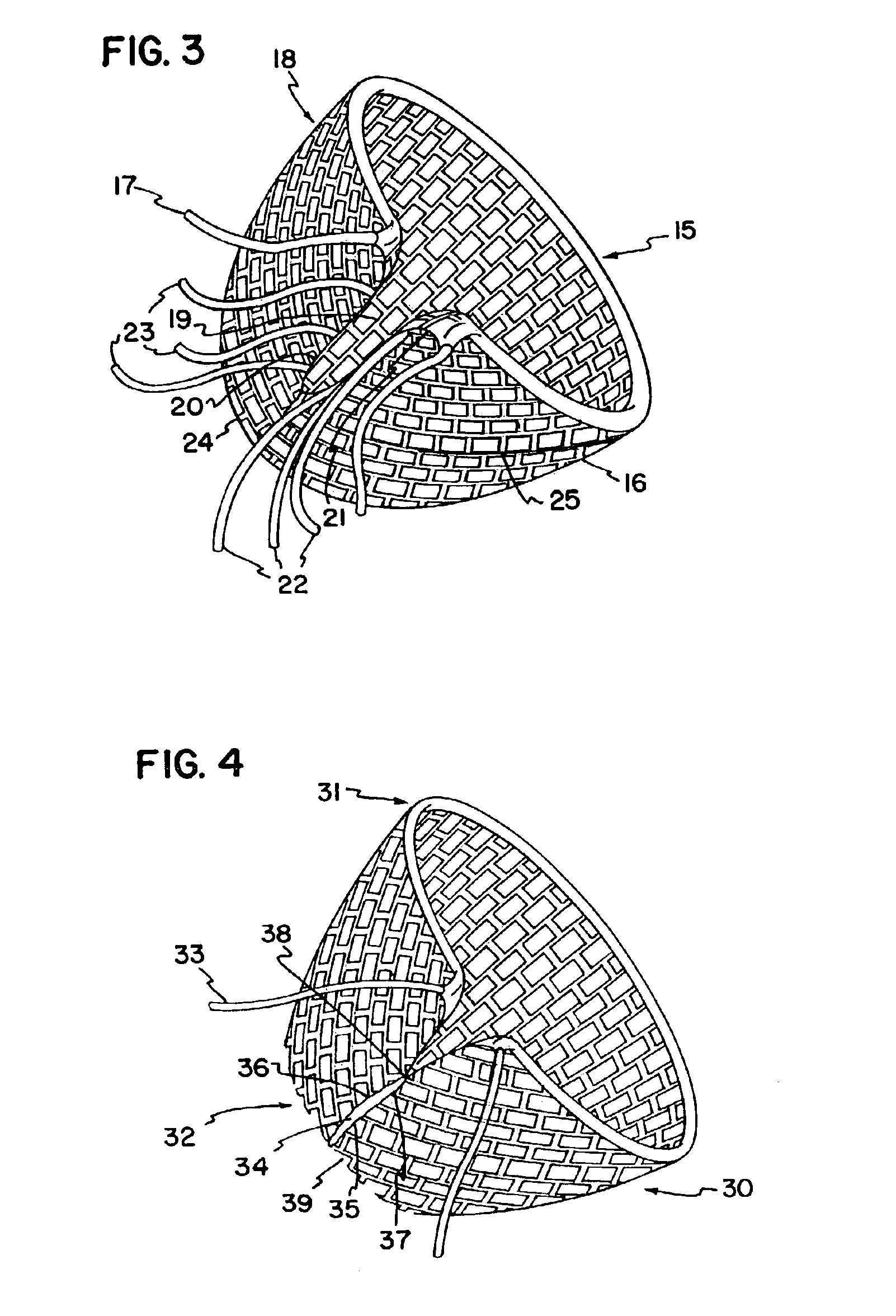 Cardiac reinforcement device