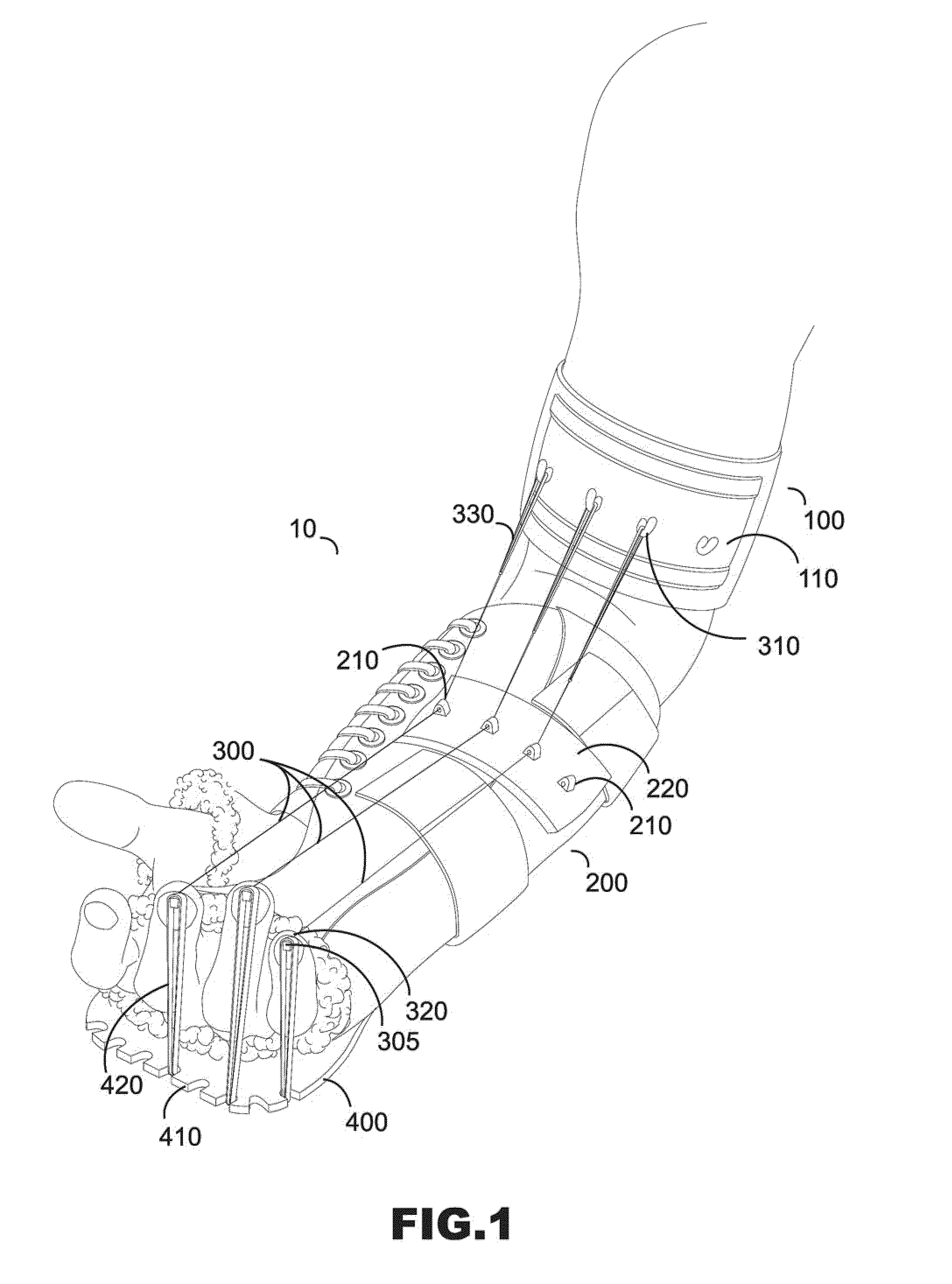 Reciprocating brace