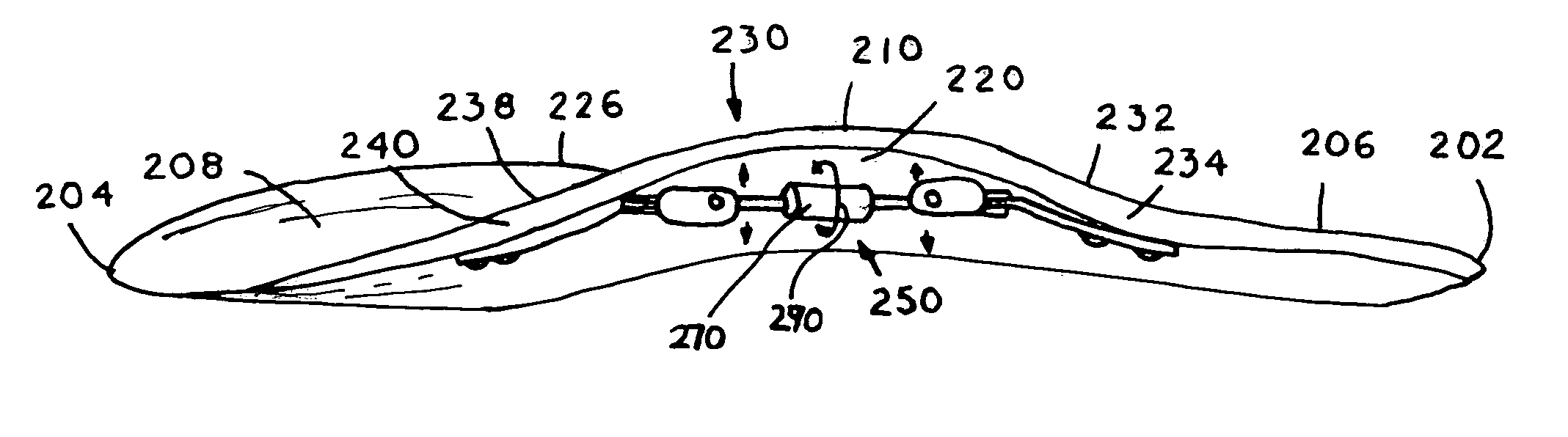 Adjustable arch support orthosis including variably tensioned arch curve and method of utilizing orthosis