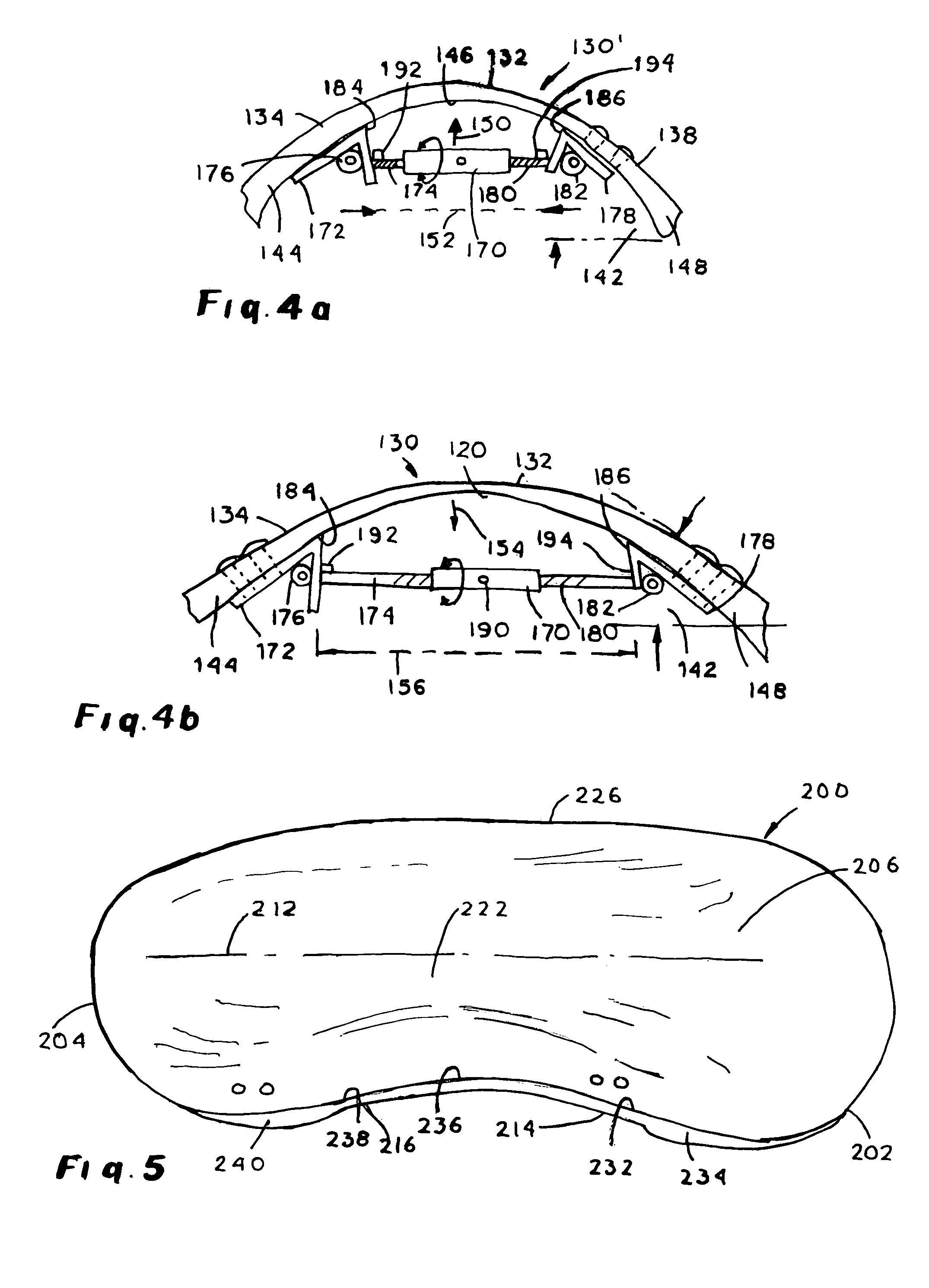 Adjustable arch support orthosis including variably tensioned arch curve and method of utilizing orthosis