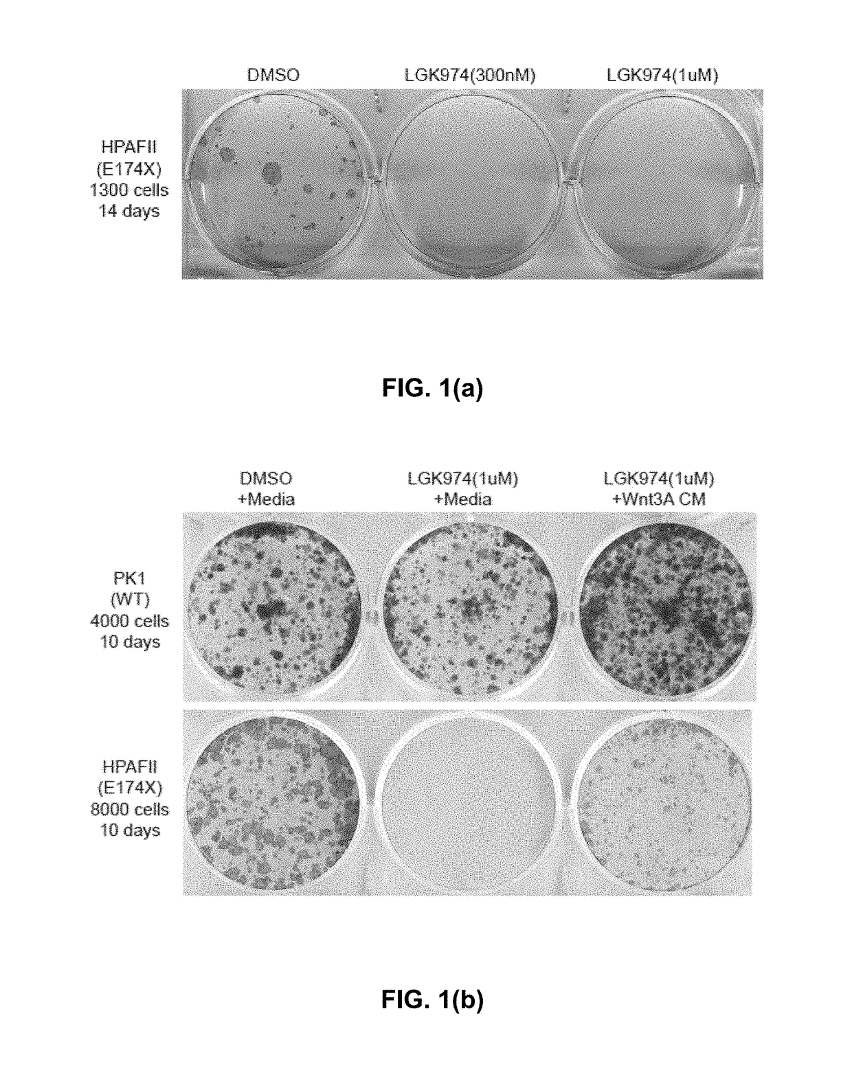 Cancer patient selection for administration of wnt signaling inhibitors using rnf43 mutation status