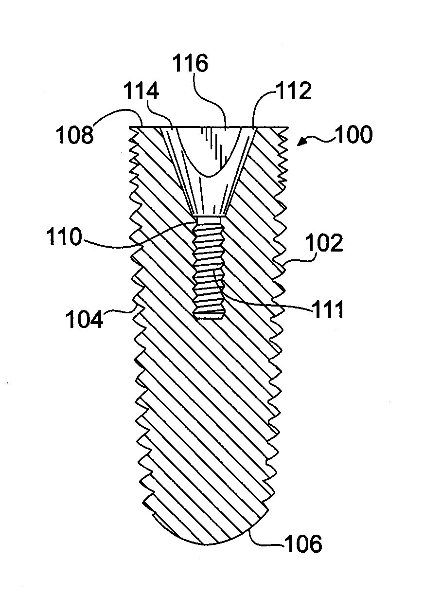 Endosseous dental implant and abutment for prevention of bone loss