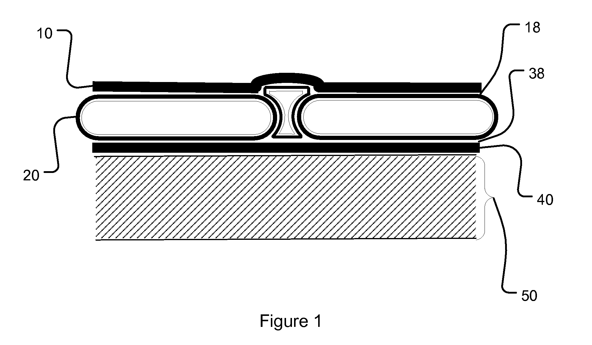 Mosaic extremity protection system with transportable solid elements