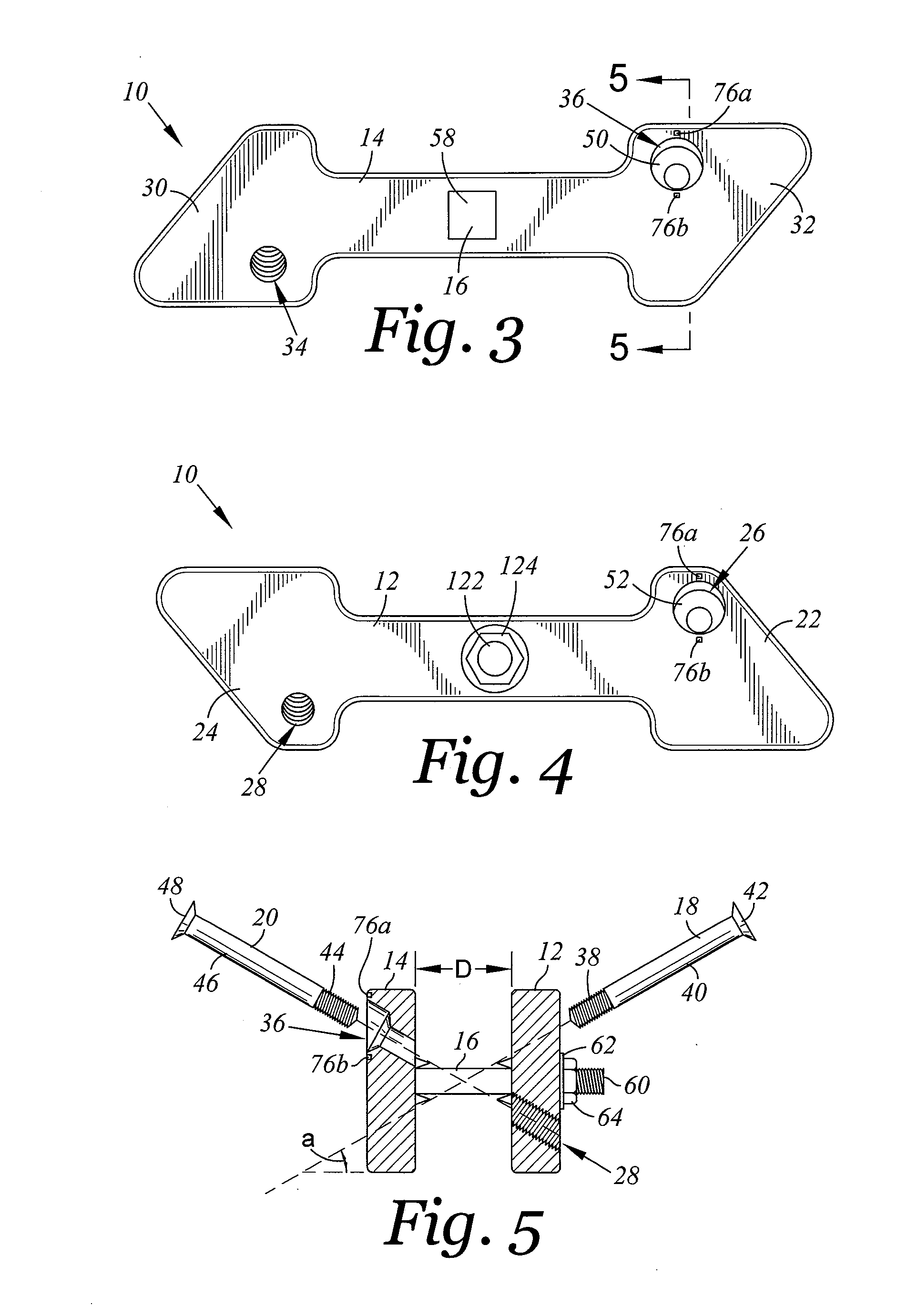 Spinal implant device with fixation plates and lag screws and method of implanting