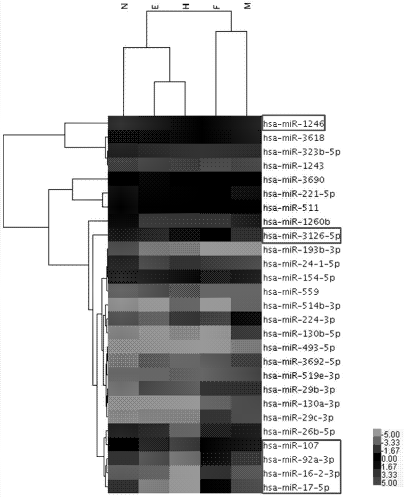 Application of serum microRNA as early diagnostic marker for hepatocellular carcinoma metastasis