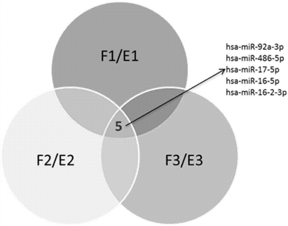 Application of serum microRNA as early diagnostic marker for hepatocellular carcinoma metastasis