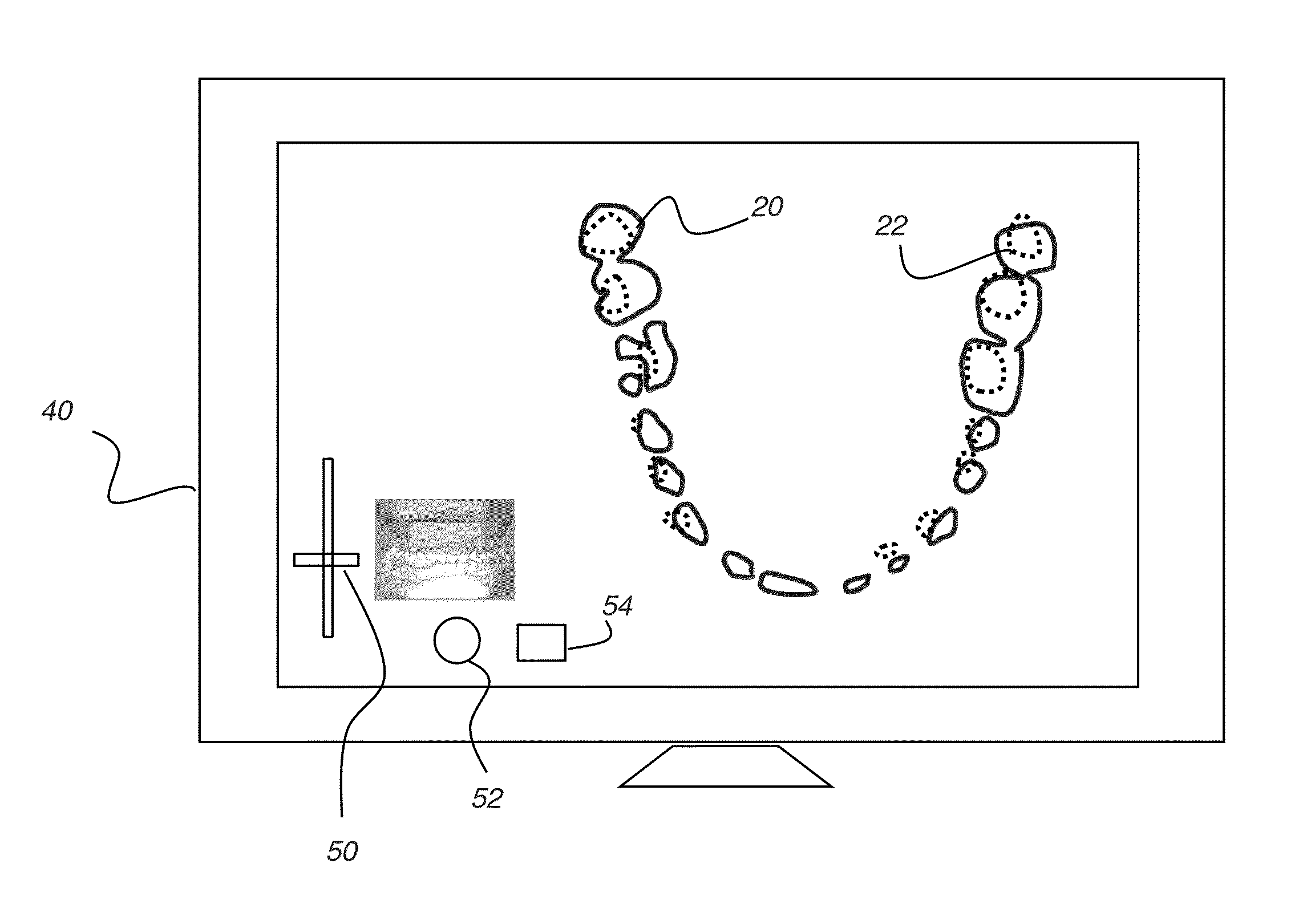 Imaging apparatus for display of maxillary and mandibular arches