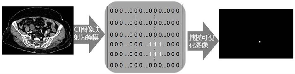 A Neural Network Based Attention Mechanism for Abdominal Lymph Node Segmentation