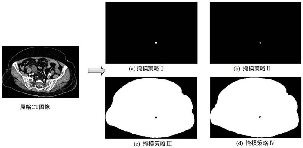 A Neural Network Based Attention Mechanism for Abdominal Lymph Node Segmentation