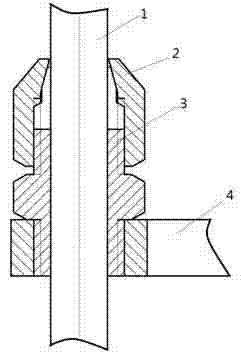 ILizarov external fixation support