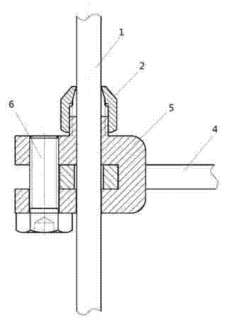 ILizarov external fixation support