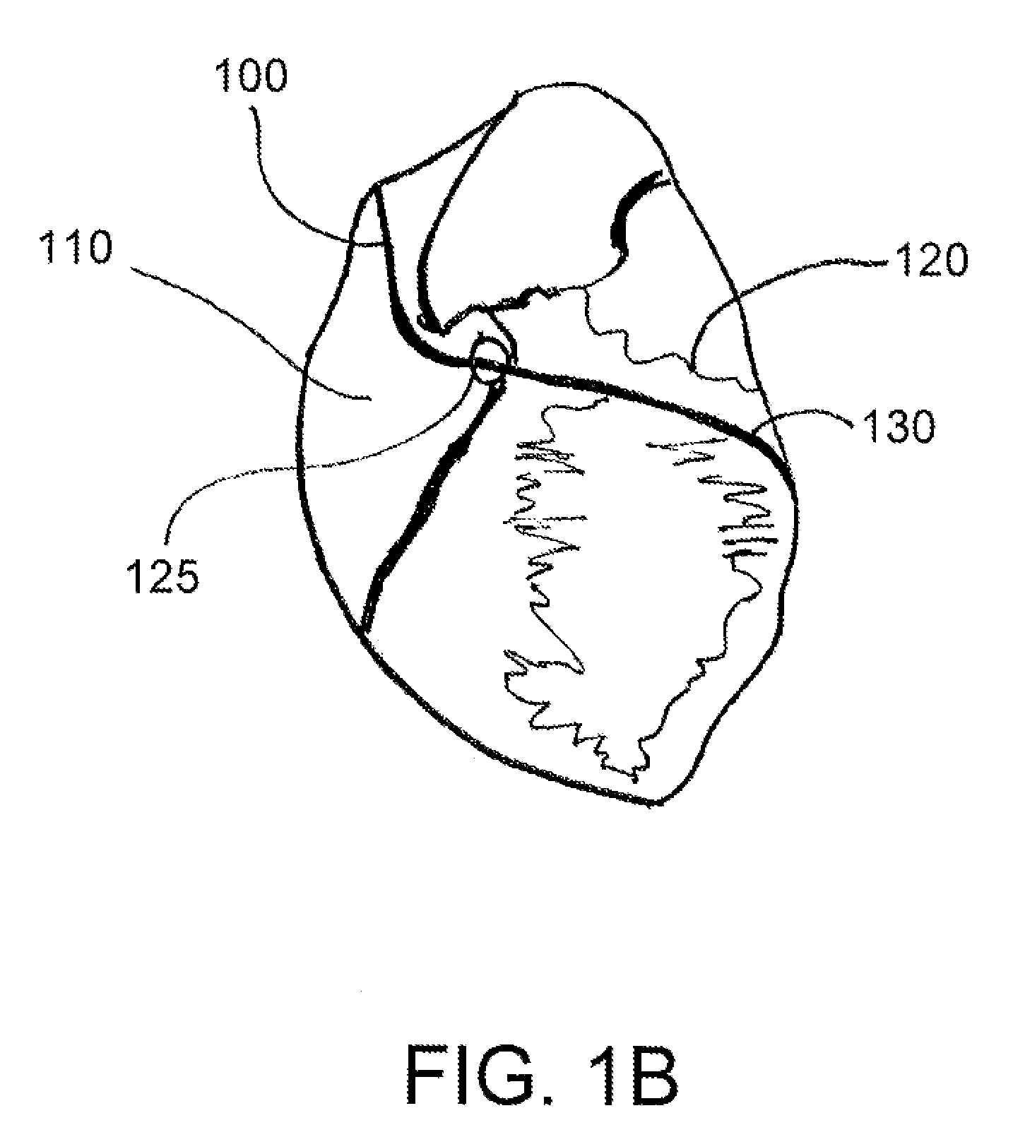 Devices, systems, and methods for obtaining biopsy tissue samples