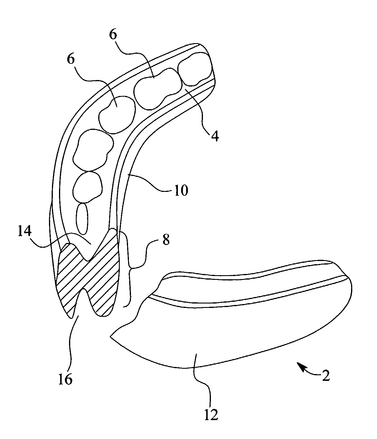 Dental appliances and systems and methods for distributing dental appliances