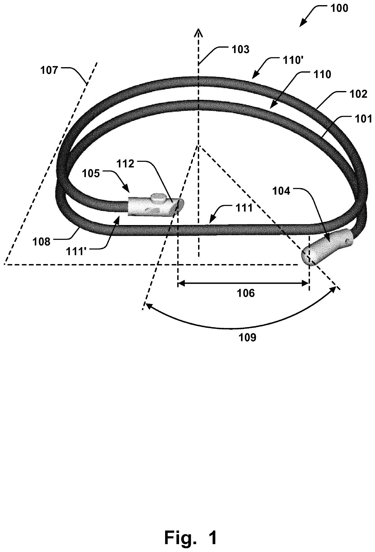 Annuloplasty implant