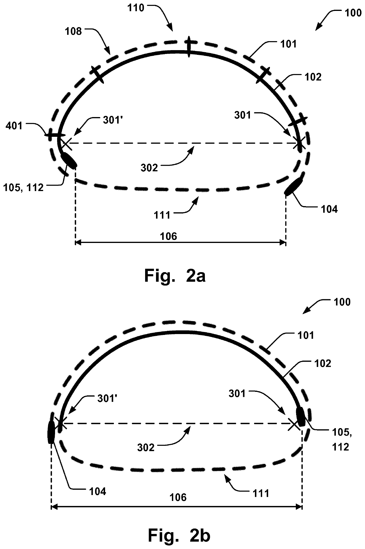 Annuloplasty implant