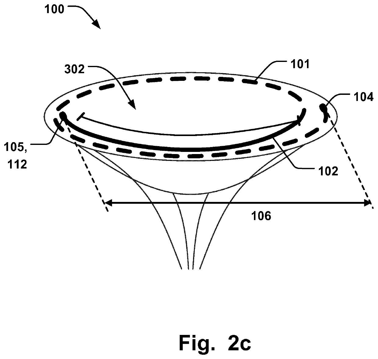 Annuloplasty implant