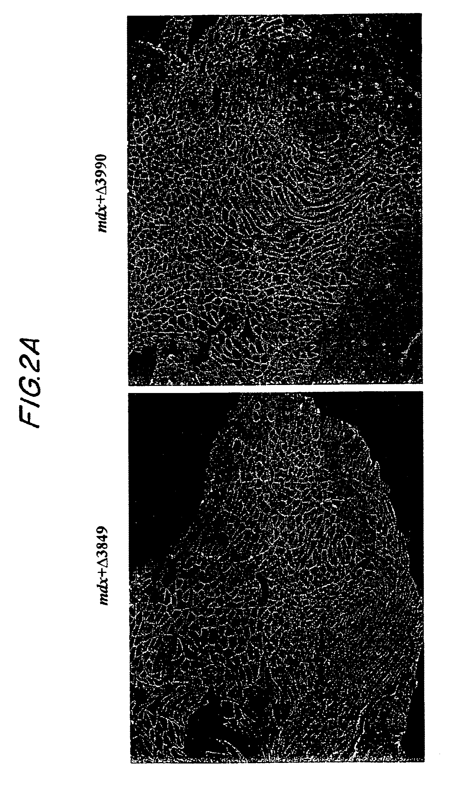 DNA sequences comprising dystrophin minigenes and methods of use thereof