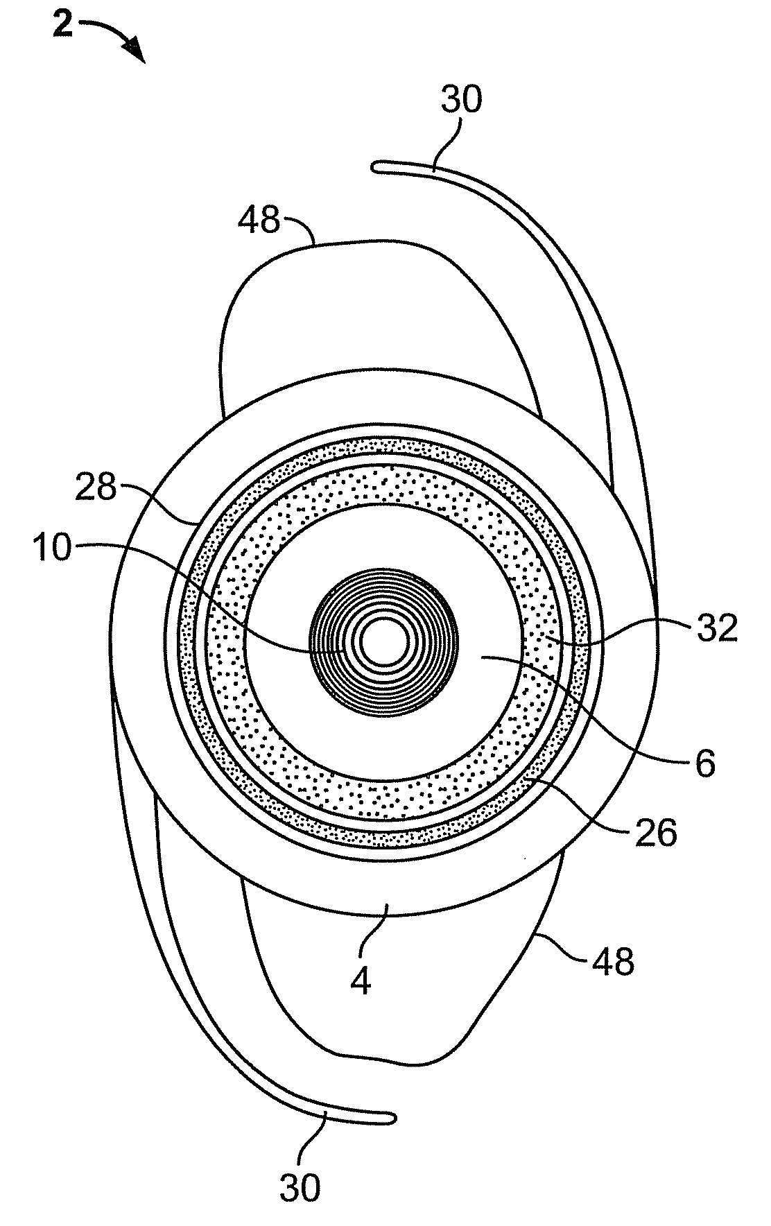 Flexible electro-active lens