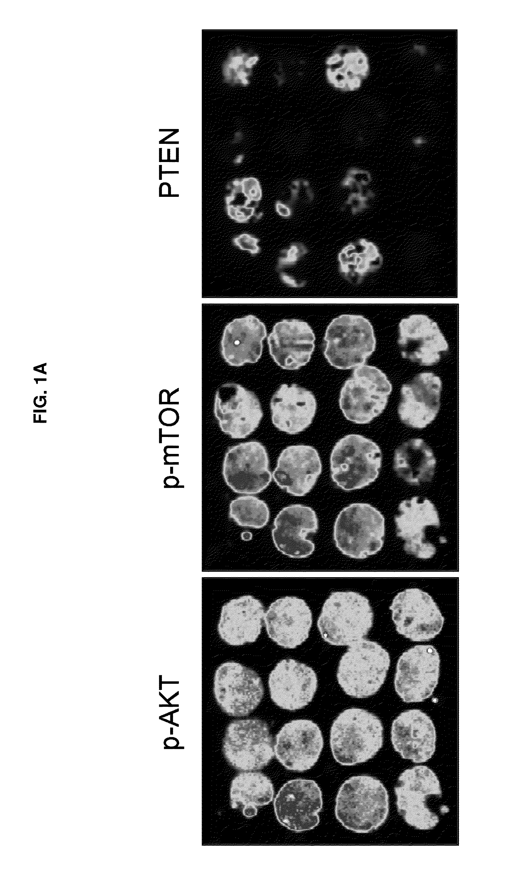 Ratio based biomarkers and methods of use thereof