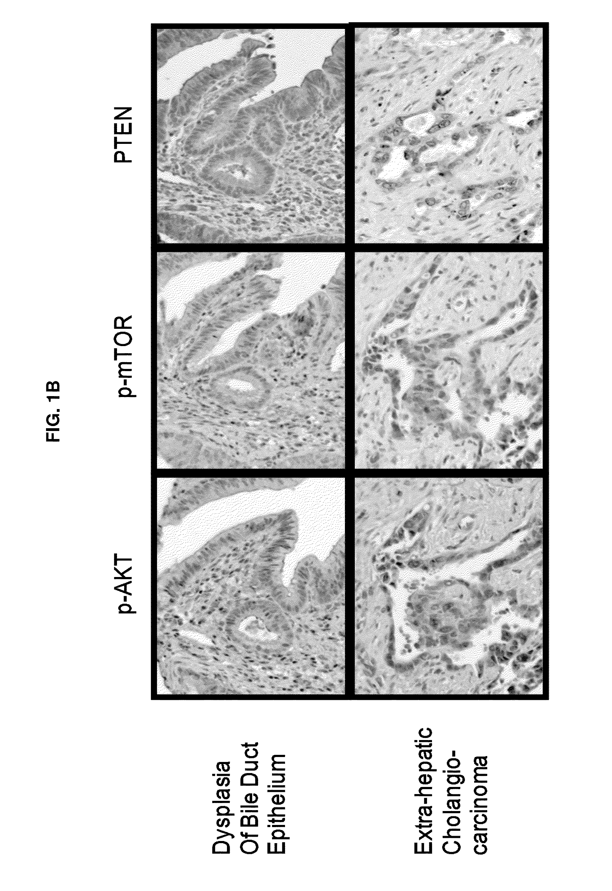 Ratio based biomarkers and methods of use thereof