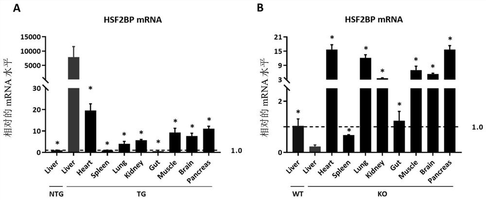 Application of heat shock factor 2 binding protein in liver ischemia-reperfusion injury and drug-induced liver injury