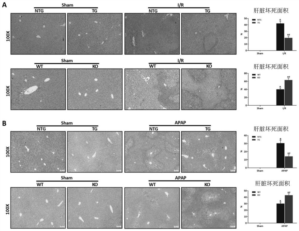 Application of heat shock factor 2 binding protein in liver ischemia-reperfusion injury and drug-induced liver injury