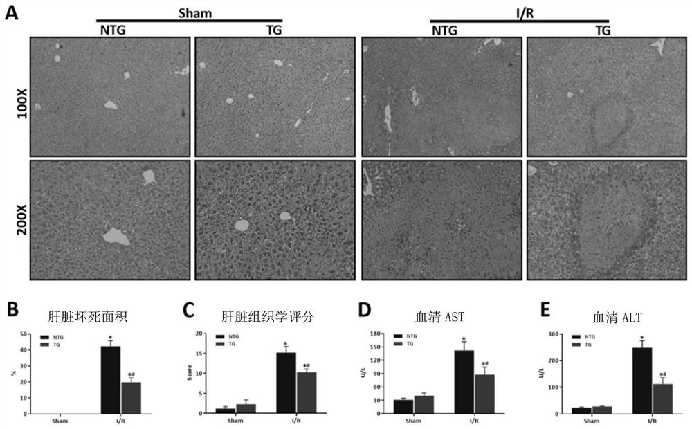 Application of heat shock factor 2 binding protein in liver ischemia-reperfusion injury and drug-induced liver injury