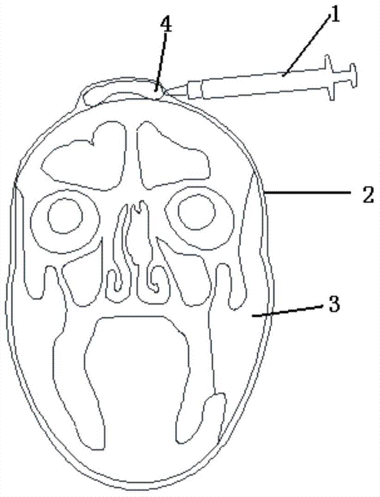 Simulation device for scalp expansion transplantation