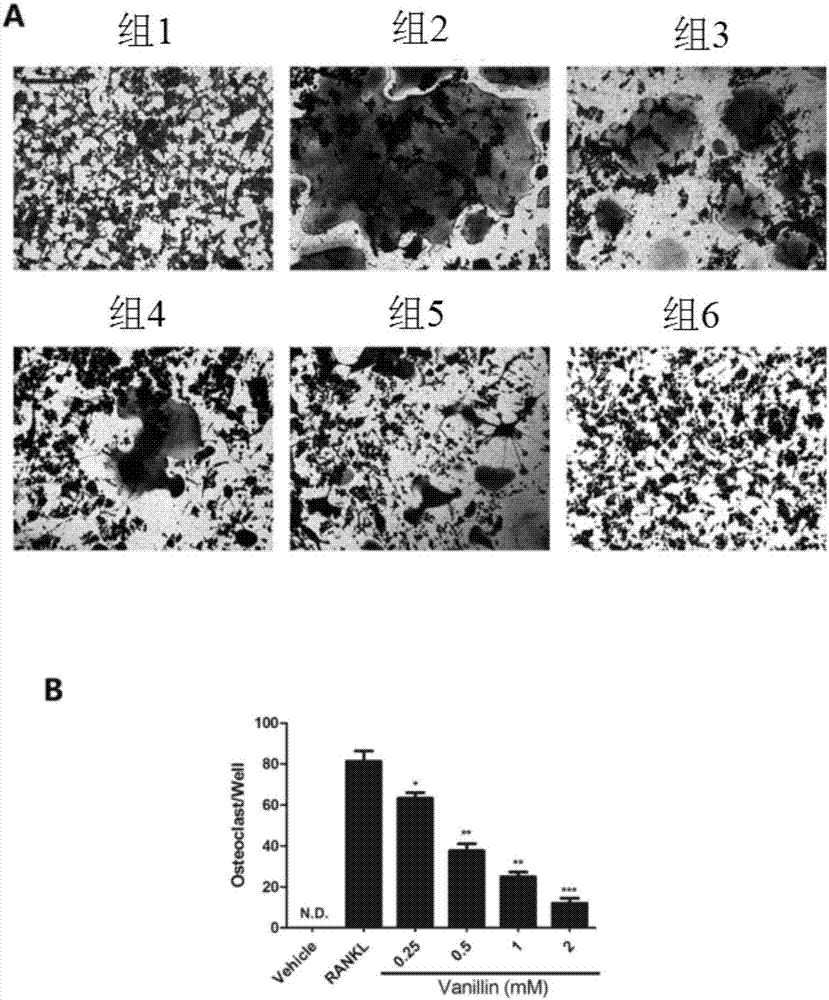 Application of vanillin in preparation of drugs for treating/preventing bone matabolic diseases