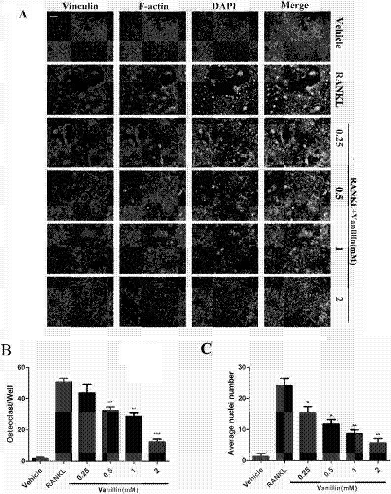 Application of vanillin in preparation of drugs for treating/preventing bone matabolic diseases