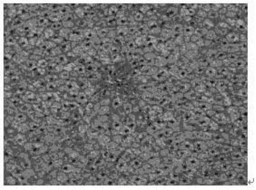 Pharmaceutical composition used for preventing and treating non-alcoholic fatty liver disease and application thereof