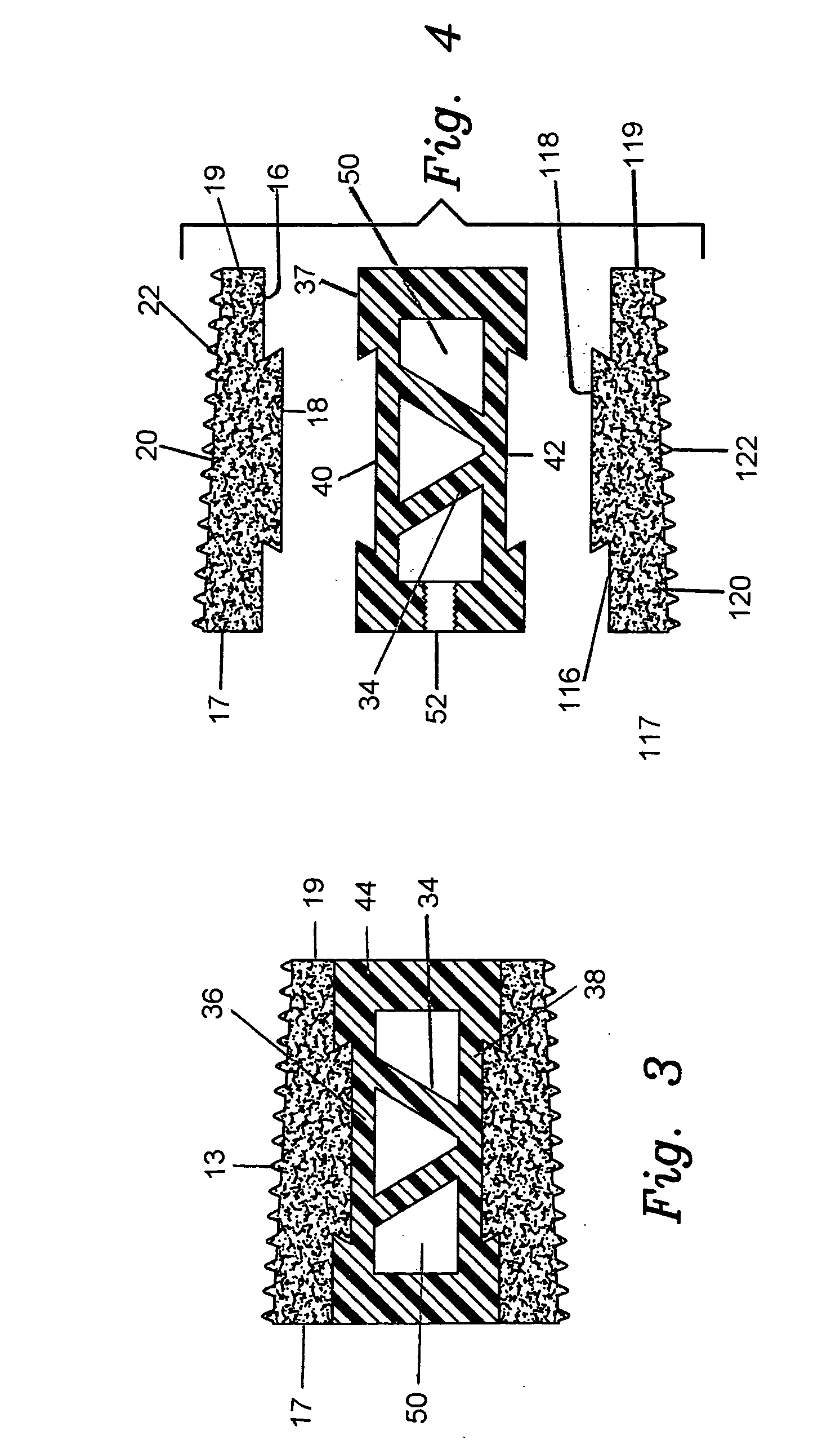 Interbody fusion hybrid graft