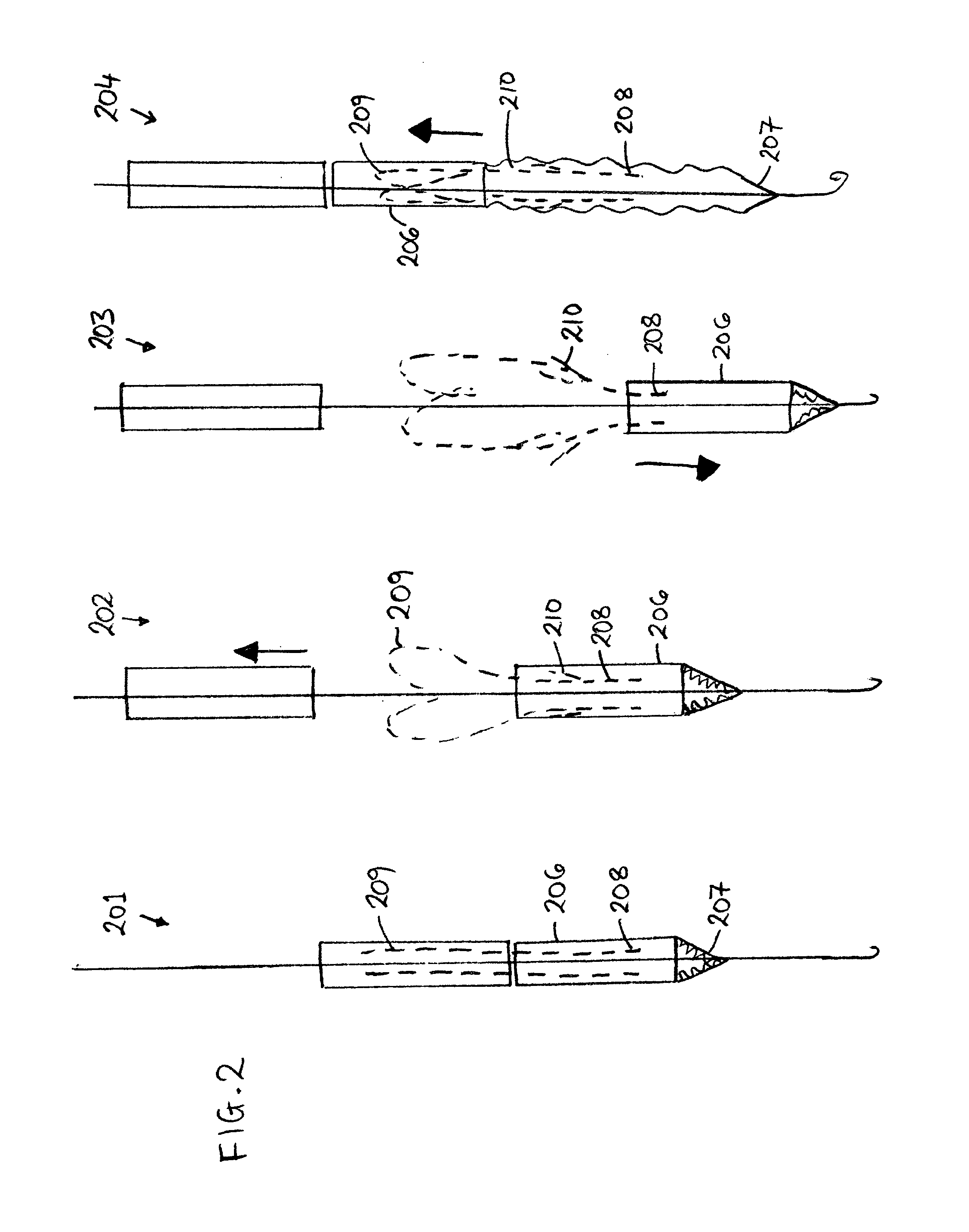 Systems, Methods and Devices for Retrograde Pericardial Release of a Prosthetic Heart Valve