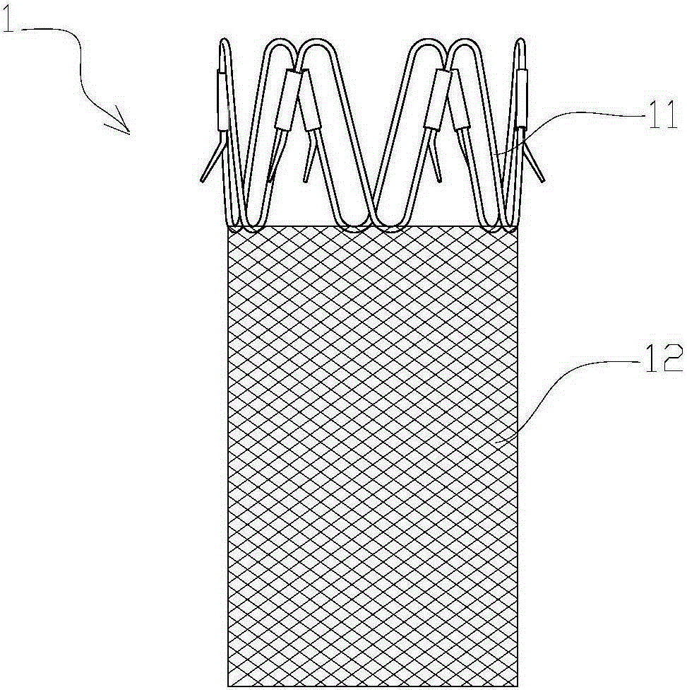 Implanted medical device