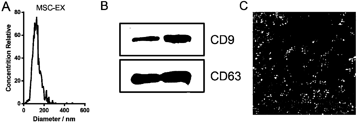 Stem cell derived exosome preparation for preventing and treating lung jury