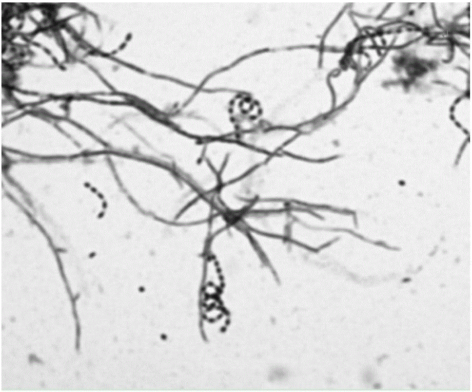 Biocontrol bacterium for preventing and treating fungal diseases of fruits and vegetables