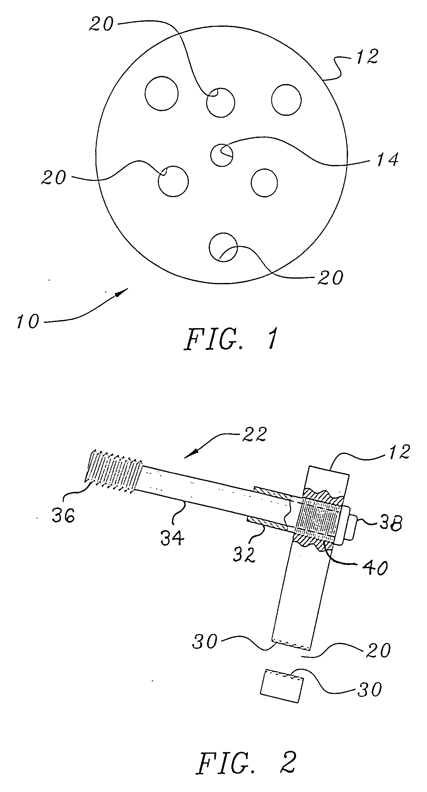 Bone end (epiphysis) fracture fixation device and method of use