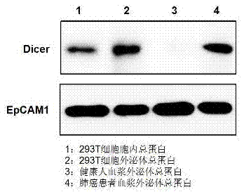 Human exosome protein, kit, and applications of human exosome protein and kit