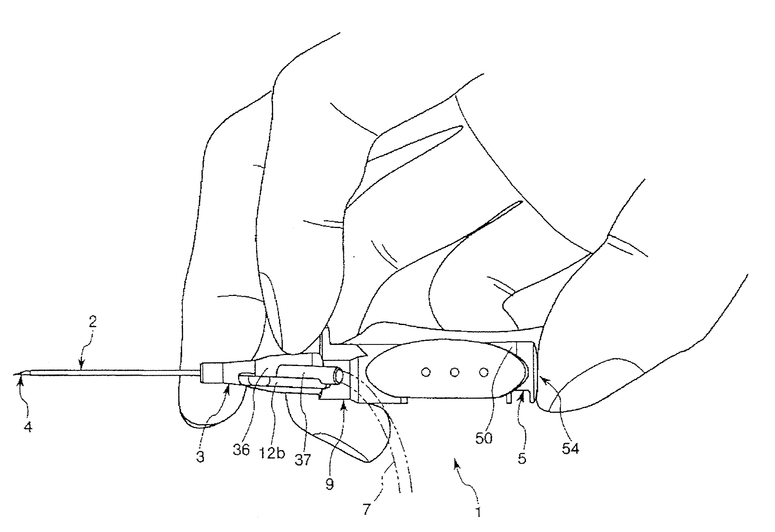 Indwelling needle assembly and method of using the same