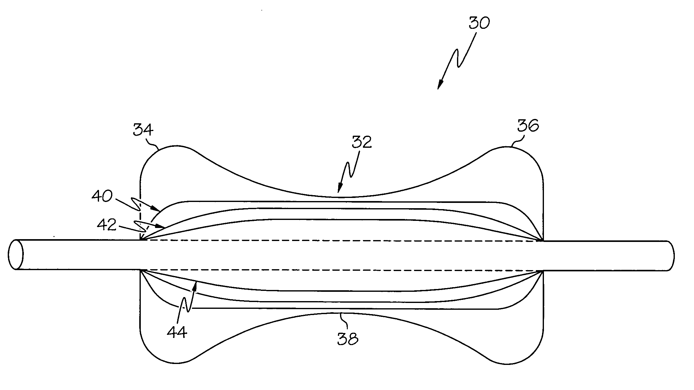 Airway balloon dilator