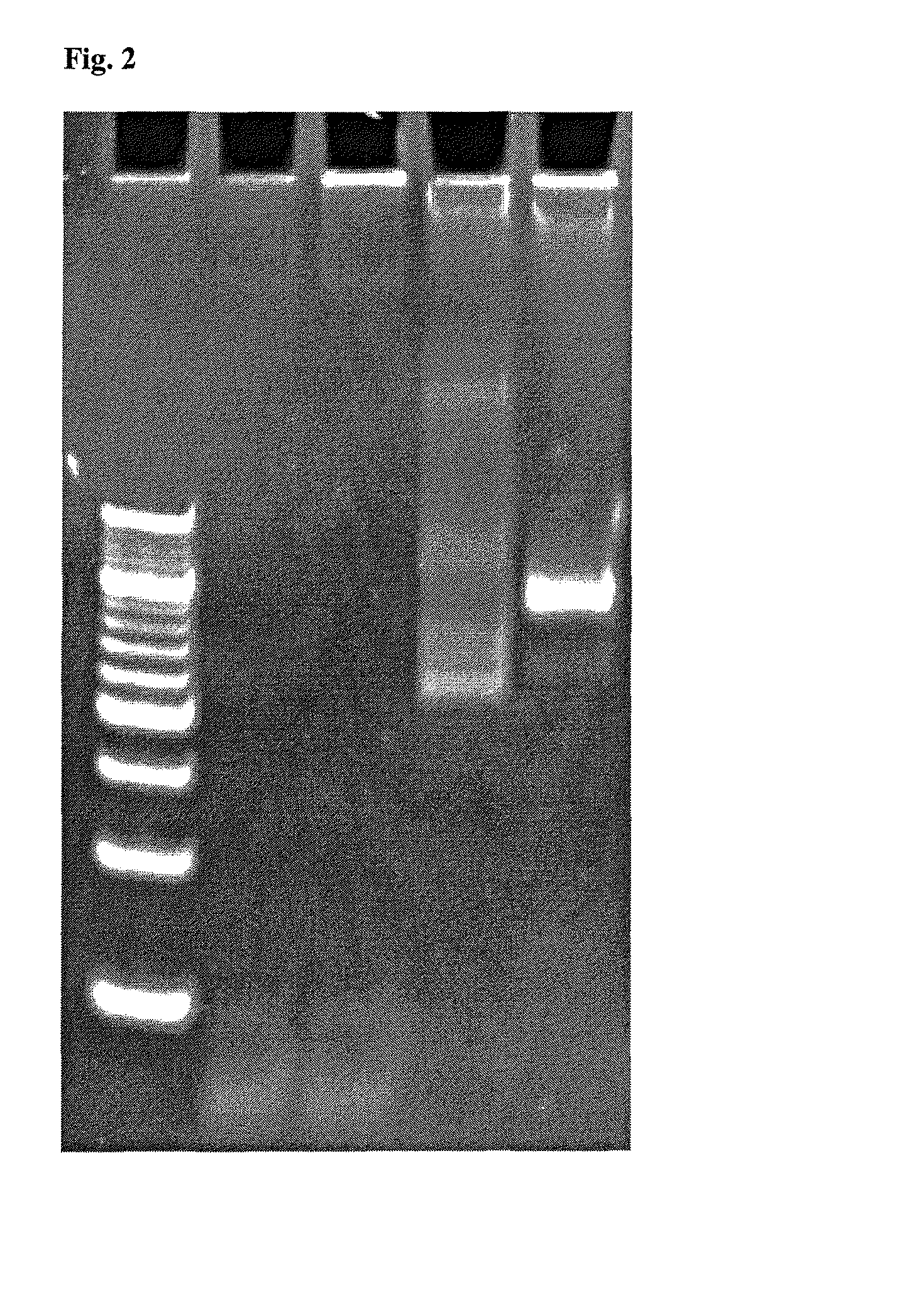 Method for detecting and/or quantifying human DNA