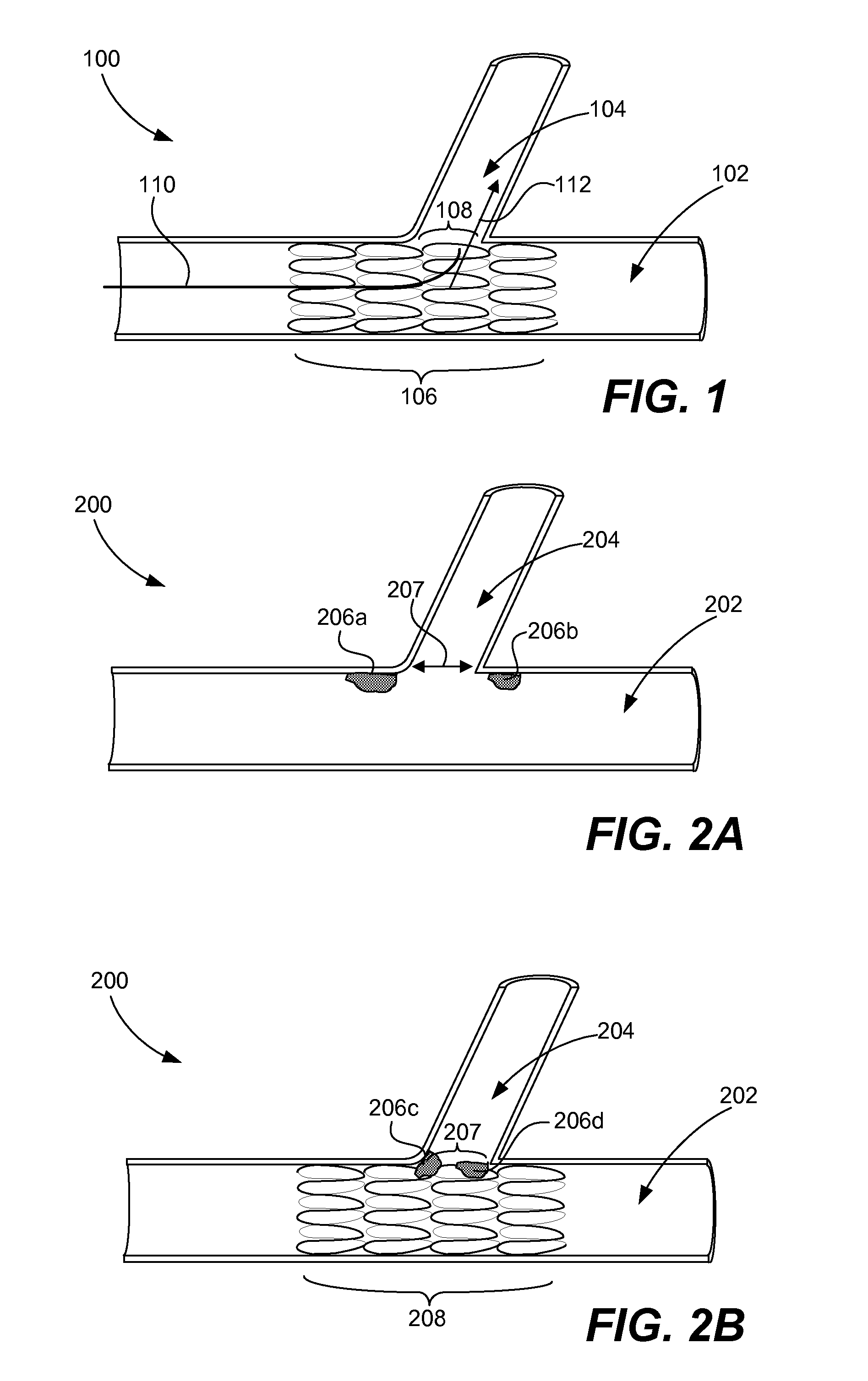 Dual balloon catheter and deployment of same