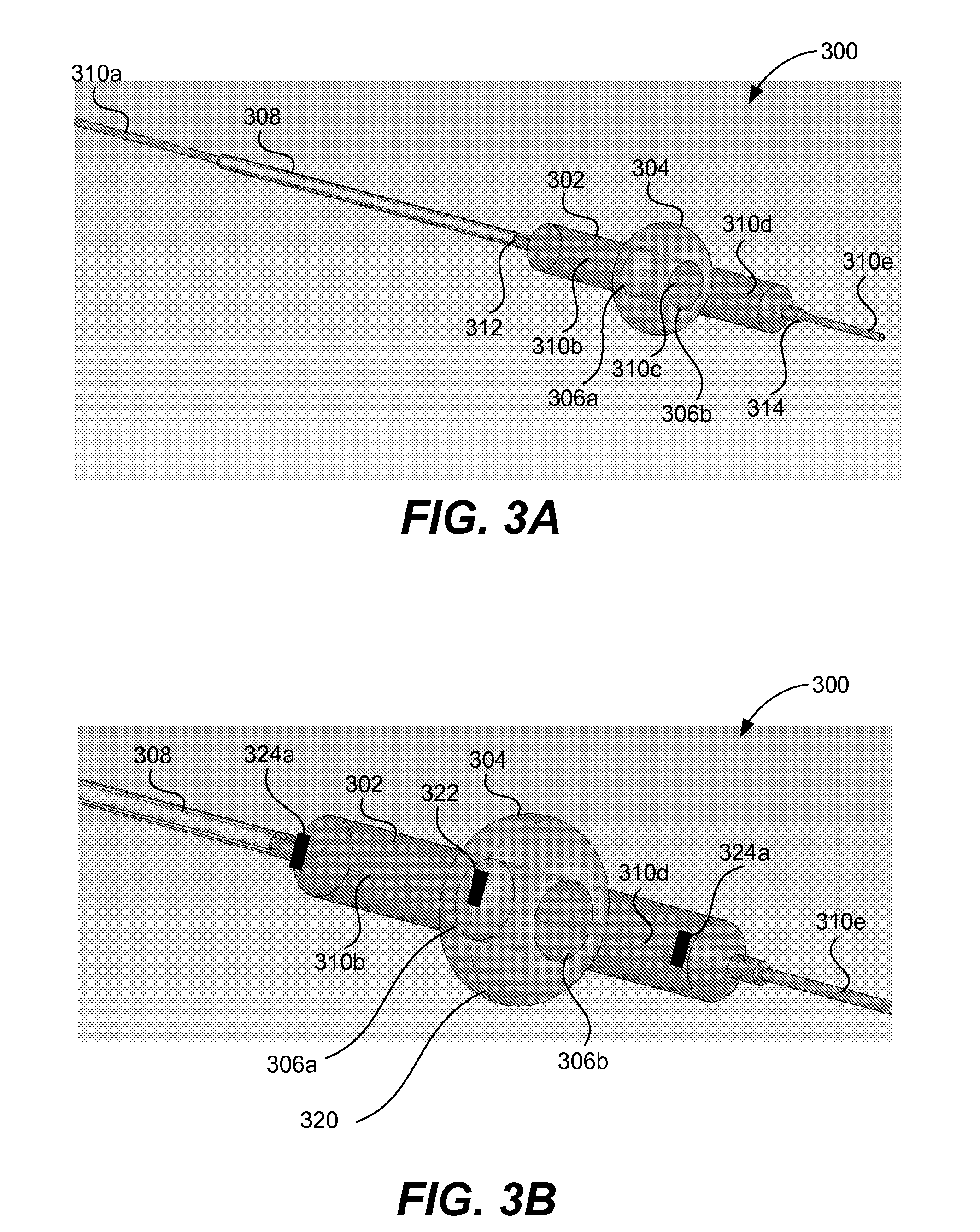 Dual balloon catheter and deployment of same