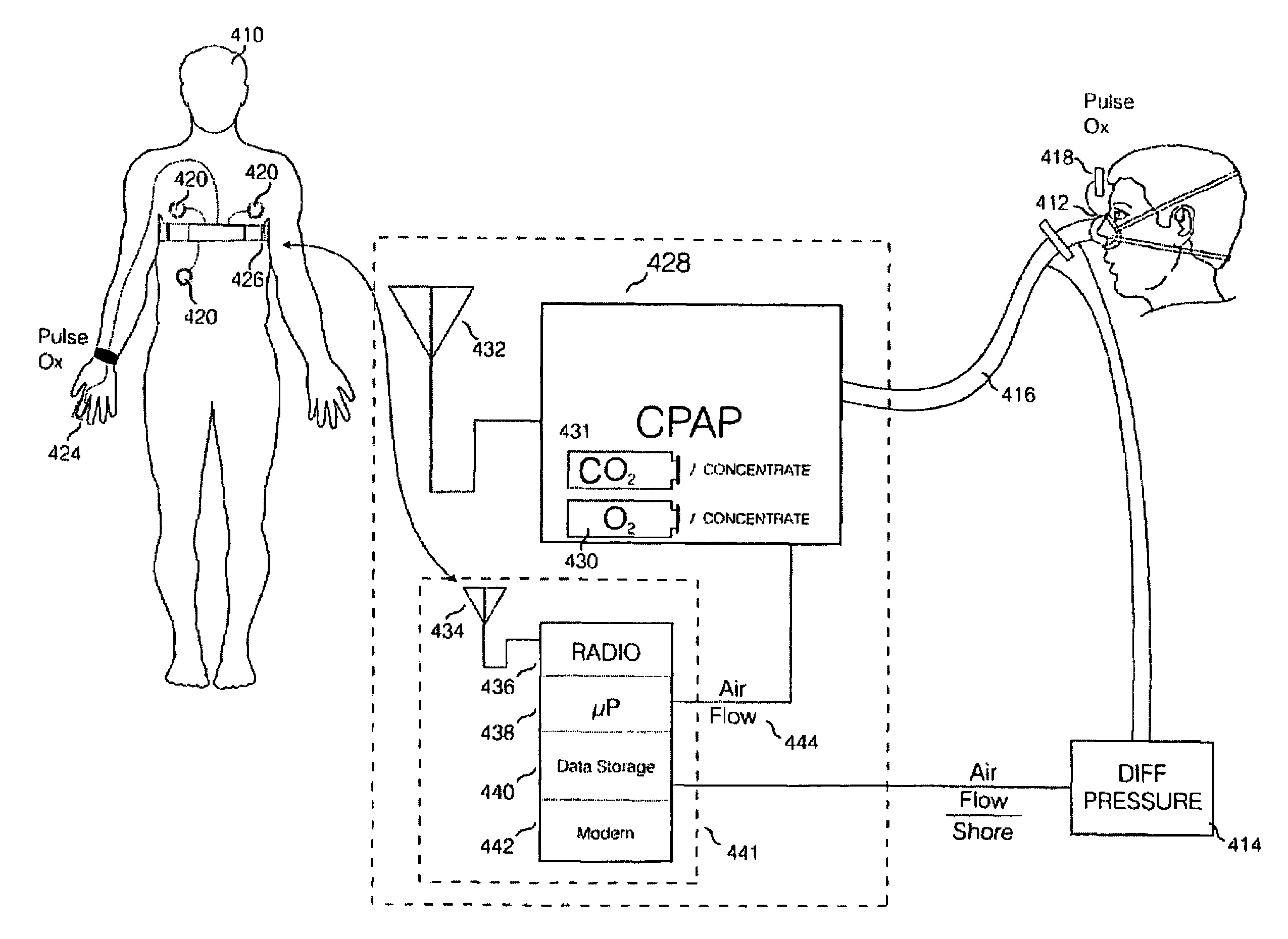 Integrated diagnostic and therapeutic system and method for improving treatment of subject with complex and central sleep apnea