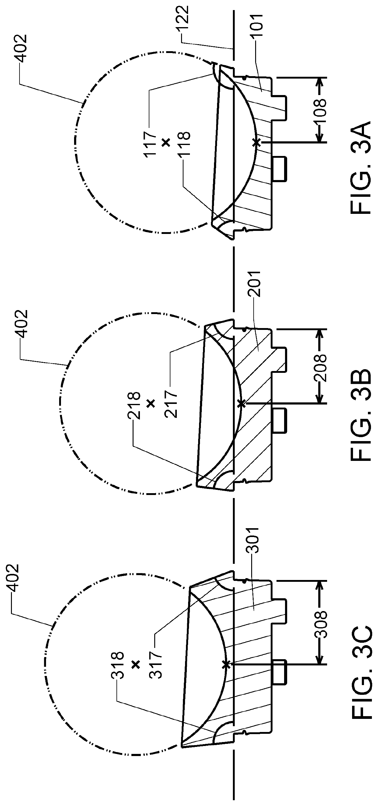 Reverse shoulder arthroplasty system